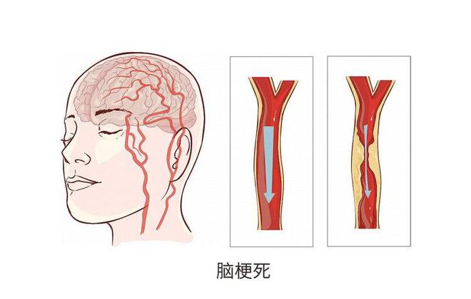 高翔是不是有病_高翔身体健康_睡出健康好身体